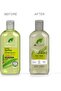 Dr Organic Tea Tree  Cleansing Shampoo, for Oily Roots & Scalps, 265ml - 4