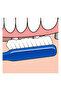 Dental Brush Implant Orthodontic - 1 Piece - 3