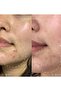 سيروم أكسس واي لعلاج حب الشباب وترطيب البشرة 15 مل - 2