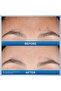 Blemish Retinol Serum 30 ml - 6