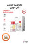 Kurutucu Losyon 30 ml