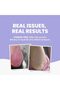 Natural Psoriasis Cream - 6