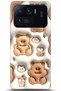 Xiaomi Mi 11 Ultra Case Hd Printed Case - Serenity Series 5047