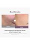 Medicube Age R Glutathione Glow Capsule Cream 50ml - 3