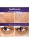 No.9 Essence | NAD+ BIO Lifting-sil Essence | Lifting, Firming, Wrinkles, Fine Lines, Elast - 5