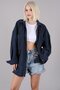 Navy Blue Oversize Shirt Jacket Mg1562 - 2