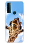 Tcl 20 Se Case Printed Silicone Colorful Illustrated Back Cover Kiss