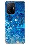 Xiaomi Mi 11t - 11t Pro Case Colorful Special Themed Patterned Silicone Tpu Deep Blue