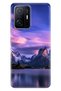 Xiaomi Mi 11t - 11t Pro Case Colorful Special Themed Patterned Silicone Tpu North