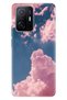 Xiaomi Mi 11t - 11t Pro Case Colorful Special Themed Patterned Silicone Tpu Pink Cloud