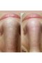 Peeling Gel + Collgen Night Mask + Facial Cleaning Foam Triple - 4
