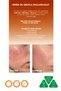3-Piece Anti-Blemish Skin Care Set with Kojic Acid |   Soap 100 Gr + Serum 30ml + Cream 50 ml - 8