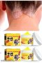 Sulphur Shampoo for Bacteriostasis, Itching Relief, Reduces Tinea Capitis, Restores Moist - 2