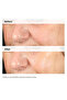 The Ordinary Alpha Arbutin 2% + Hyaluronic Acid Serum - 30ml - 3