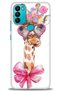 General Mobile Gm 21 Plus Case Hd Printed Case - Giraffe with Glasses + Full Screen Protector