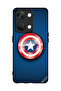 غطاء حماية لهاتف OnePlus Nord 3 5G Shield