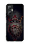 غطاء حماية لهاتف Infinix Hot 20 5G بتصميم King Artwork - 2