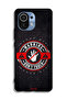 Xiaomi Mi 11 Protective Case Cover Warning Do Not Touch - 2