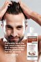 2 Pieces of Garlic Extract Shampoo Containing Biotin and Keratin Against Hair Loss 250ml. - 6