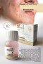 Acne Care Solution 30 Ml - 3