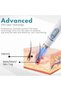 Skin Tag Removal Pen, Non-Invasive Mole and Wart Removal Pen, Dark Spots Remover for Face and Body, - 8