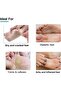Foobetik Cream, For Dry, Calloused & Cracked Feet, Moisturizes & Soothes Feet, 100gm - 4