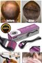 Beard and Hair Remover Roller: Wrinkle Reduction with Titanium Needle Derma Roller, Skin Young - 5