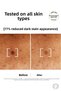 BRIGHT REVEAL ANTI-DARK SPOT SERUM EFFECTIVE ON ACNE, SUN AND AGE SPOTS 30ML DEMBA1476 - 5