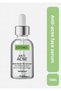 Anti-Acne Face Serum & Anti-Acne Face Perfecting Serum 15ml