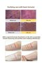 Foaming Gel Cleanser & Mask for the Skin Vita C Plus All in One Pack Foam Cleanser 200 ml - 5
