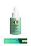 Anti-Blackhead and Acne Serum 30ml - Niacinamide Zinc Azelaic Acid