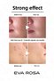 Anti-Blackhead and Anti-Acne Facial Cleansing Gel 250 ml (Balances sebum levels) - 6