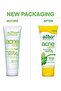 ACNEdote Face & Body Scrub, 8 Ounces Tube (Pack of 4) - 5