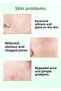 Salicylic Acid Anti-Acne Care Oil Control Mask 120 gr - 3