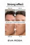 Anti-Blackhead and Acne, Anti-Blemish, Tone Equalizer Anti Acne Skin Serum 30 ml - 6