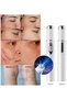 Blue Light Therapy Pen, Face Acne Scar Removal, Spider Veins, Scar Wrinkles, Puffy Eyes, Dark - 4