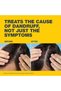 Ketoconazole Anti-Dandruff Treatment Shampoo, 100 ml - 8