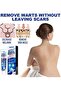 Wart Remover Ointment - 6