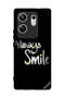 غطاء حماية لهاتف Infinix Zero 30 4G - Always Smile