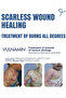 ® Gel 50g –Made in Italy - Scarless Advanced Formula For Burns , SunBurns ,Skin Inflammation - 5