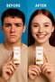 Beauty Anti-Acne Serum 10 ml |   Anti-Acne, Drying, Skin Purifying Serum, 10 ml - 5