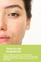 Anti-Acne and Blackhead Snap Serum (Salicylic Acid & Tea Tree) |   Drying Effect |   30 ml) - 5