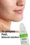 Anti-Acne Blackhead Skin Serum + Vitamin C Hyaluronic Acid Skin Serum Advantageous Set of Two - 2