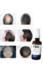 HAIR GROWTH SPRAY 50ML | Natural Growth of Hair | Reducing The Risk of Hair Fall and Breakage - 2