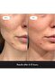 Invisible Hydrocolloid Acne Pimple Patch Ultra Thin Spot Treatment (39 count) for Face - 4