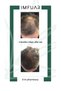 Supports New Hair Growth, Prevents Hair Loss, Hair Serum 50 ml, 63 Different Active Ingredients - 5