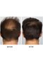 Hair Cream - 100% Natural to Prevent Hair Loss,[2 pcs] - 5