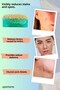 5X Anti Acne Serum - Effective and Cleansing Bar Soap - 4