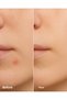 Clearly Spot Patch 24 Pack Band I Hydrocolloid, Niacinamide Content Anti-Acne / Band - 5