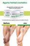 Foot and Heel Crack Care Cream 100ml (Set of 9) - 4